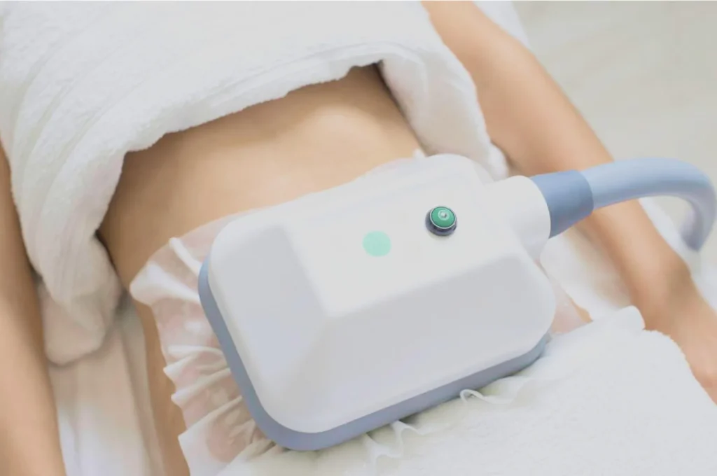 How Fat Freezing and HIFU Work Together? 3 advantages to combining Fat Freezing and HIFU Doncaster