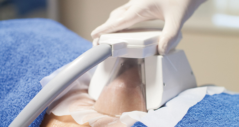 How Fat Freezing and HIFU Work Together? 2 Multiple Areas in One Session HIFU and Fat Freezing Doncaster