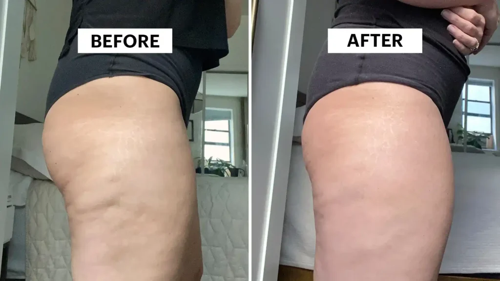 Do Toning Exercise Doncaster Really Tackle Cellulite?