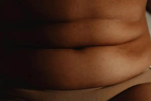 The Hidden Connection: How Stress Shapes Your Fitness and Body Composition 3 image of what stress can do on the stomach area and how Lipo 360 Doncaster can help to change your body shape.
